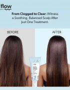 so!flow Cleansing Trichological Peeling peeling pro pokožku hlavy 100 ml