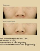 Some By Mi Yuja Niacin 30 Days Miracle Brightening Toner rozjasňující tonikum 150 ml
