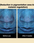 Some By Mi Yuja Niacin Anti Blemish Daily Mask rozjasňující plátýnková maska pro sjednocení barevného tónu pleti velké balení 30 ks