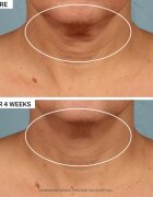 StriVectin Tighten & Lift TL Advanced Tightening Neck Cream Plus liftingový zpevňující krém na krk a dekolt 50 ml