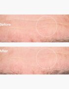 The Ordinary Hyaluronic Acid 2% + B5 hydratační sérum s ceramidy 30 ml