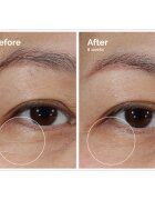 The Ordinary Lacto-PDRN* 4% + B9 Eye Cream vyhlazující oční krém proti vráskám očního okolí 15 ml