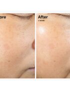 The Ordinary Rice Lipids + Ectoin Microemulsion lehká hydratační emulze pro zklidnění pleti 60 ml