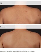 The Ordinary Salicylic Acid 0.5% Body Serum zdokonalující tělové sérum s kyselinou salicylovou 240 ml