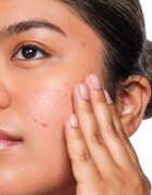 The Ordinary Salicylic Acid 2% Solution sérum s kyselinou salicylovou 30 ml