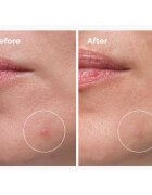 The Ordinary Sulfur 10% Powder-to-Cream Concentrate lokální péče proti akné 5 g