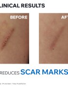 Uriage Bariederm Cica+ Repairing Cream reparativní krém s obsahem mědi a zinku 100 ml