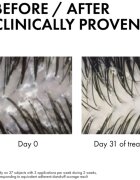 Vichy Dercos Serum 10 ošetřující péče proti lupům 90 ml