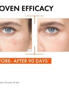 Vichy Liftactiv Supreme rozjasňující pleťové sérum s vitaminem C 20 ml