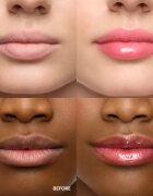 WONDERSKIN Lip Rehab Serum Oil olej na rty odstín amour 3.57 ml