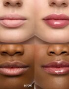 WONDERSKIN Lip Rehab Serum Oil olej na rty odstín Honey 3.57 ml