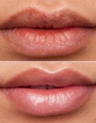 WONDERSKIN Lip Rehab Therapy Oil olej na rty s hydratačním účinkem odstín Clear 357 ml