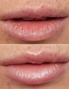 WONDERSKIN Lip Rehab Therapy Oil olej na rty s hydratačním účinkem odstín Clear 357 ml