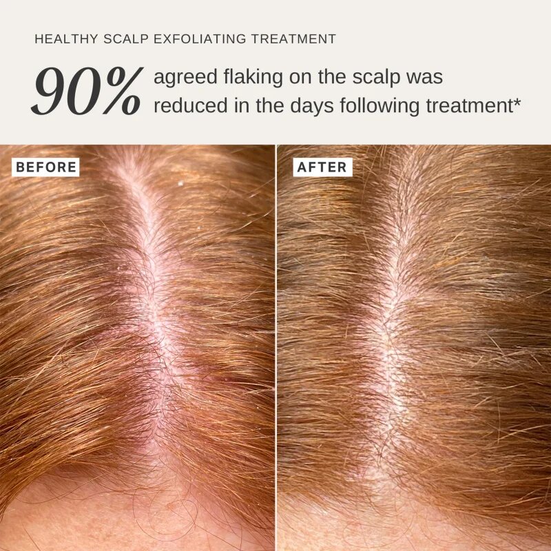 Alpha-H Healthy Scalp exfoliační roztok na hlavu 100 ml