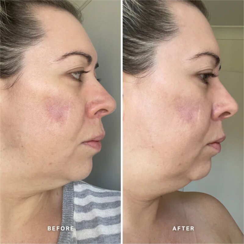 Alpha-H Vitamin A sérum s vitamínem A 25 ml