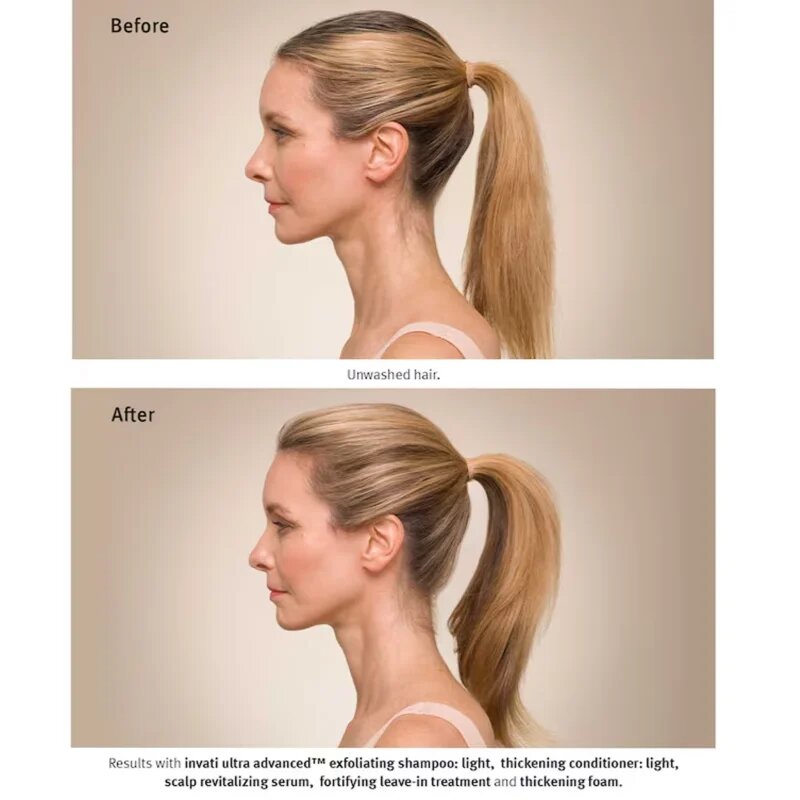 Aveda Invati Ultra Advanced™ Revitalizing Scalp Serum obnovující sérum na vlasy a vlasovou pokožku 30 ml