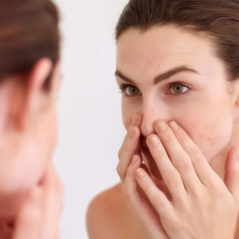 Avène Cleanance micelární voda pro mastnou a smíšenou pleť 400 ml