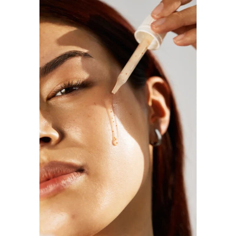 Carbon Theory Succinic Acid & Niacinamide obnovující pleťové sérum pro problematickou pleť 30 ml
