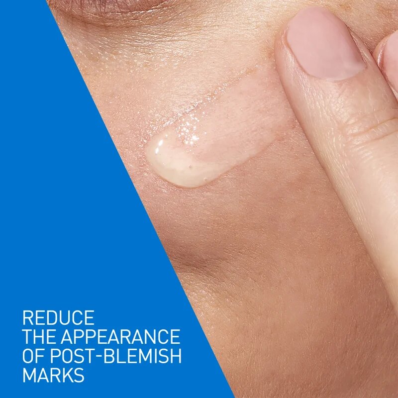 CeraVe Control Cleanser & Retinol Serum Duo komplexní péče proti nedokonalostem aknózní pleti