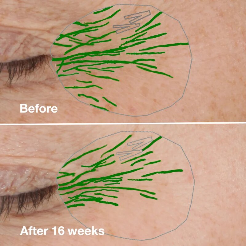 Clinique Smart Clinical™ Repair Wrinke Correcting Serum pleťové sérum pro korekci vrásek 75 ml