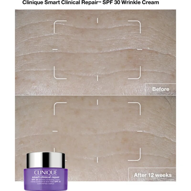 Clinique Smart Clinical™ Repair Wrinkle Correcting Cream SPF 30 protivráskový krém SPF 30 75 ml