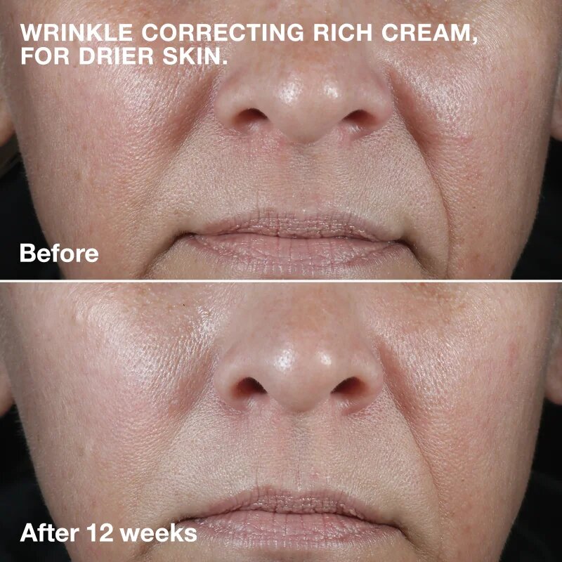 Clinique Smart Clinical™ Repair Wrinkle Correcting Cream vyživující protivráskový krém 75 ml
