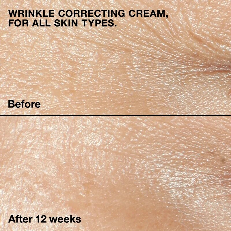 Clinique Smart Clinical™ Repair Wrinkle Correcting Cream vyživující protivráskový krém 75 ml