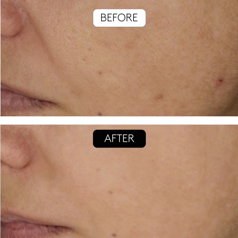 Cocunat Clinical Beauty Filler sérum proti stárnutí pleti s mikrojehličkováním 5 ml