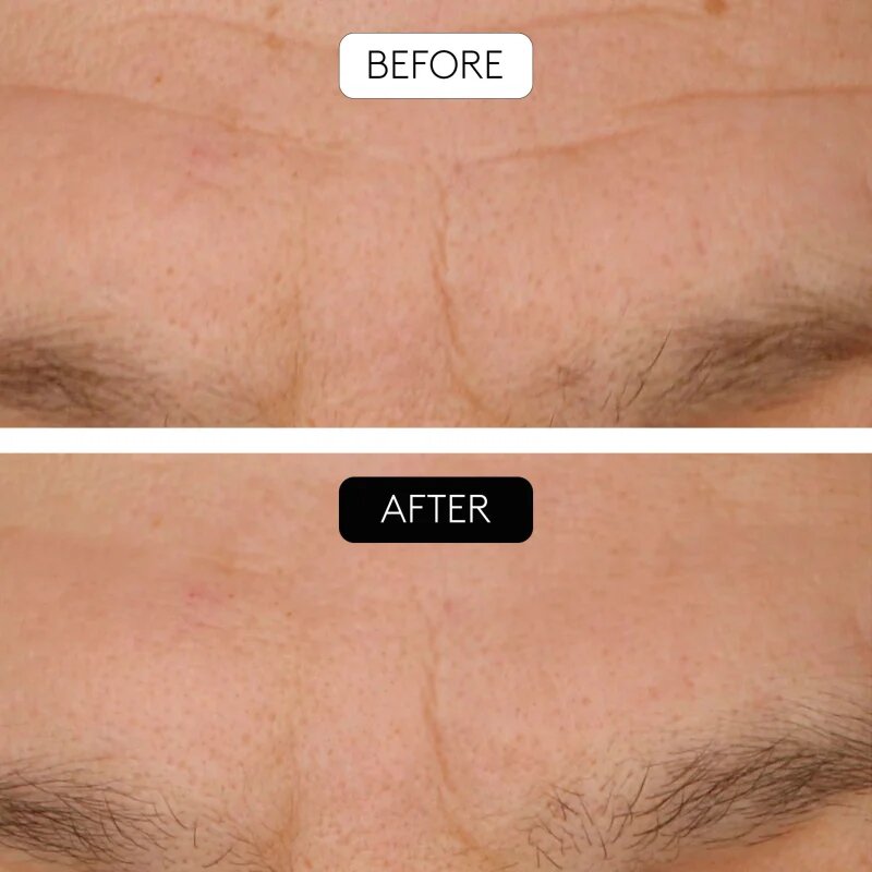Cocunat Clinical Beauty Filler set proti stárnutí pleti