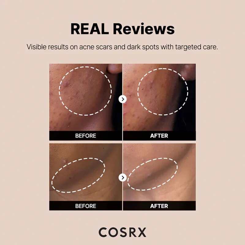 Cosrx The Alpha-Arbutin 2 Discoloration Care sérum pro pleť s hyperpigmentací 50 ml