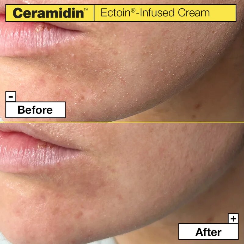 Dr. Jart+ Ceramidin™ Ectoin-Infused Cream hydratační krém na obličej s ceramidy 50 ml