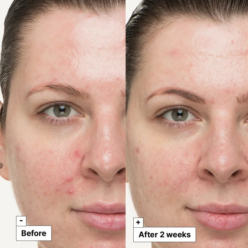 Dr. Jart+ Cicapair™ So Soothing Treatment lokální péče neutralizující zarudnutí 30 ml