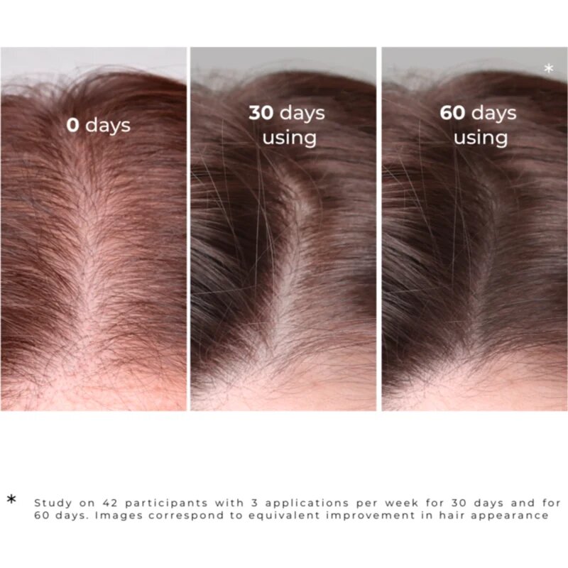 Elfa Pharm Intensive Cosmetic Intensive Hair Therapy Burdock Serum sérum proti padání vlasů s růstovým aktivátorem 100 ml