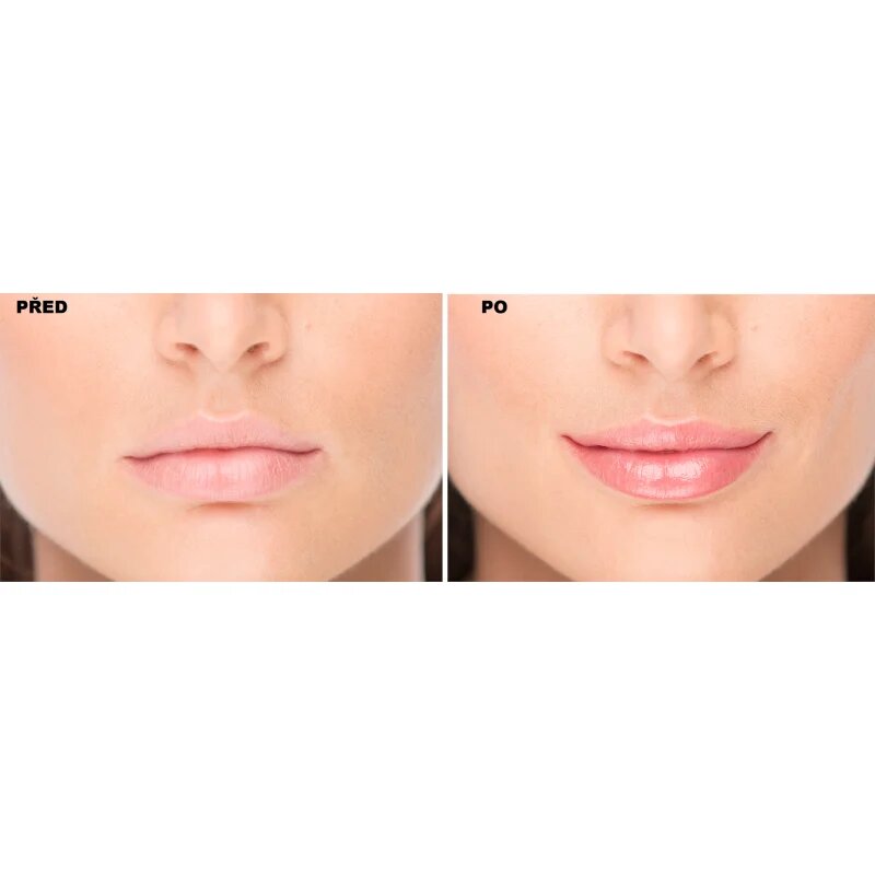 FacEvolution LipPlus Booster péče pro zvětšení objemu rtů odstín Transparent 5 ml