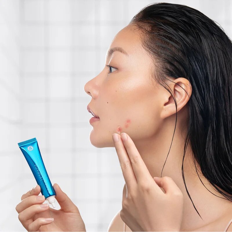 FOREO ESPADA™ BHA+PHA Blemish Solution lokální gel na akné 15 ml