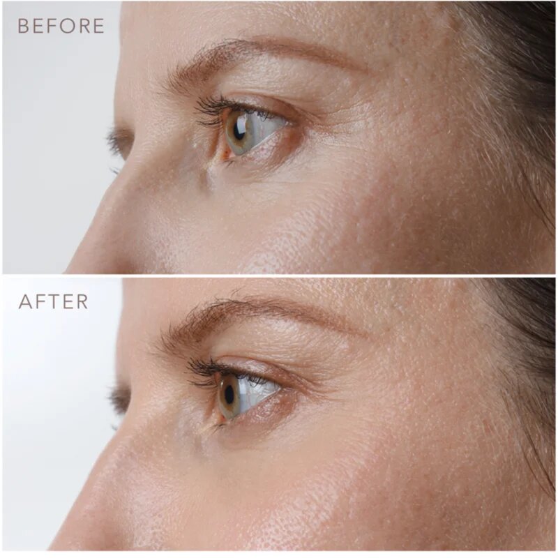 FOREO IRIS™ Firming Eye Serum omlazující oční sérum 15 ml