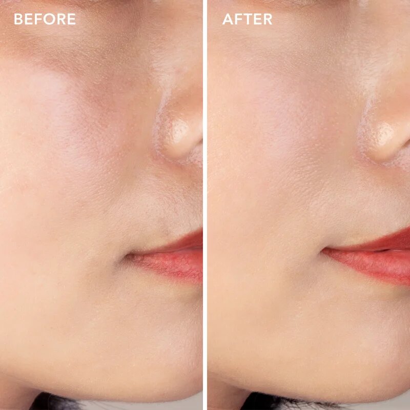 FOREO SUPERCHARGED Barrier Restoring Essence Mist esenciální mlha na obličej pro obnovu kožní bariéry 110 ml