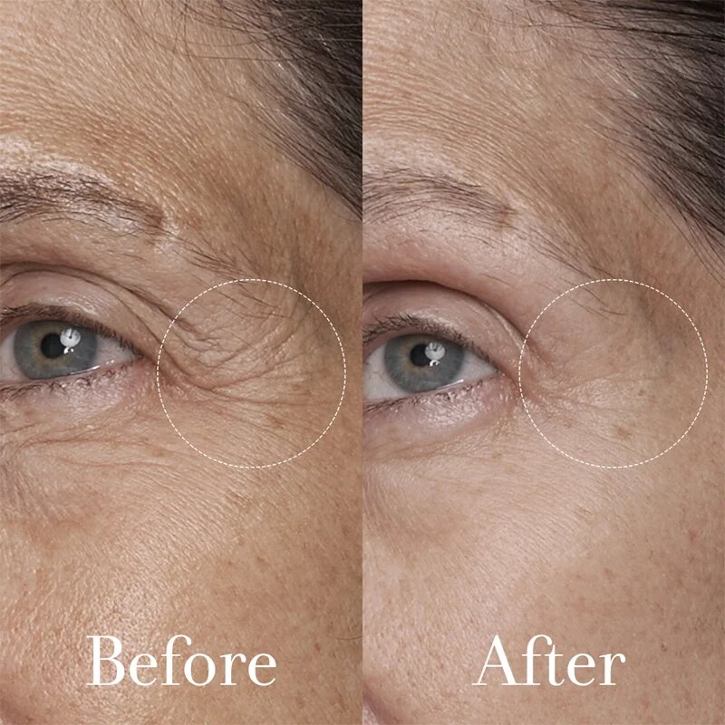 fresh Black Tea Age Renewal Eye Concentrate omlazující oční krém 15 ml