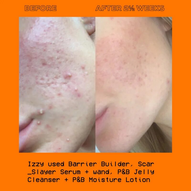 Glow Hub The Scar Slayer rozjasňující sérum proti pigmentovým skvrnám 30 ml
