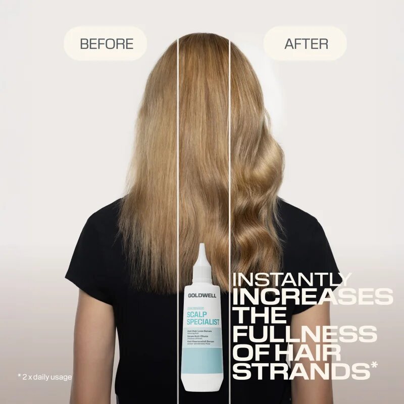 Goldwell Dualsenses Scalp Specialist Anti-Hair Loss Serum sérum proti vypadávání vlasů 150 ml