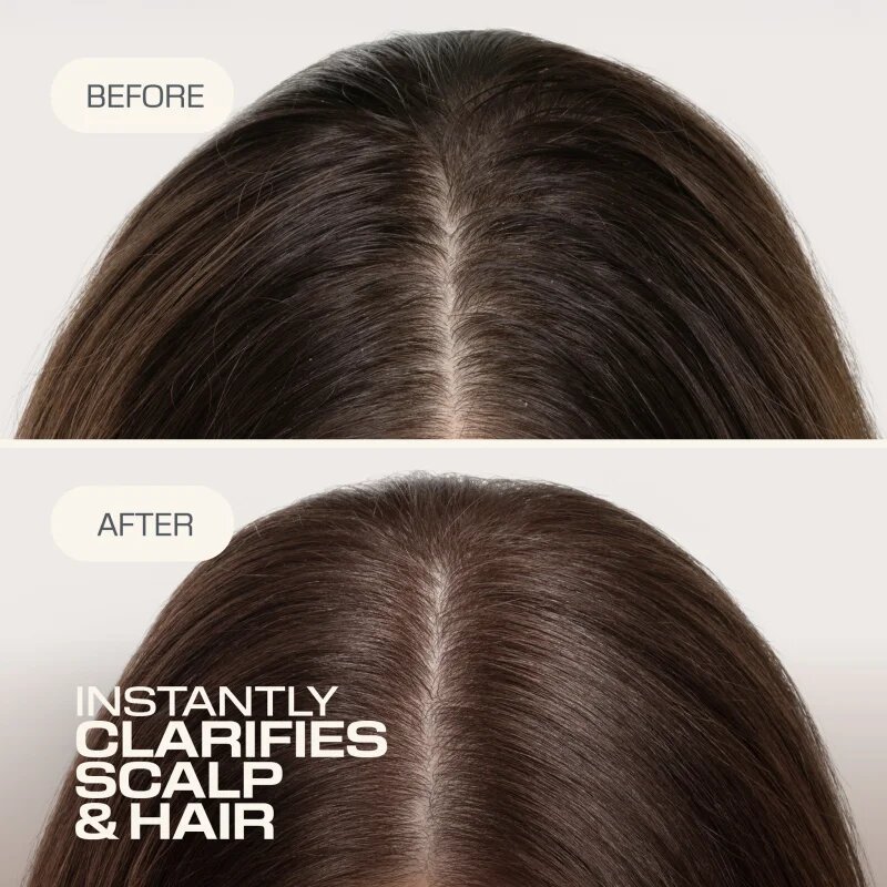 Goldwell Dualsenses Scalp Specialist Clarifying Shampoo hloubkově čisticí šampon 250 ml