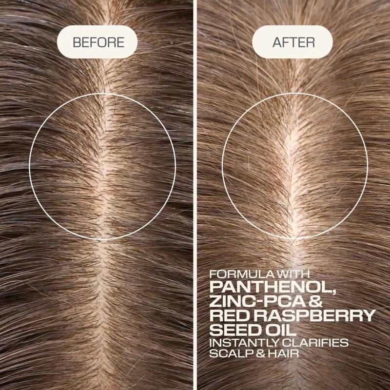 Goldwell Dualsenses Scalp Specialist Clarifying Shampoo hloubkově čisticí šampon 250 ml