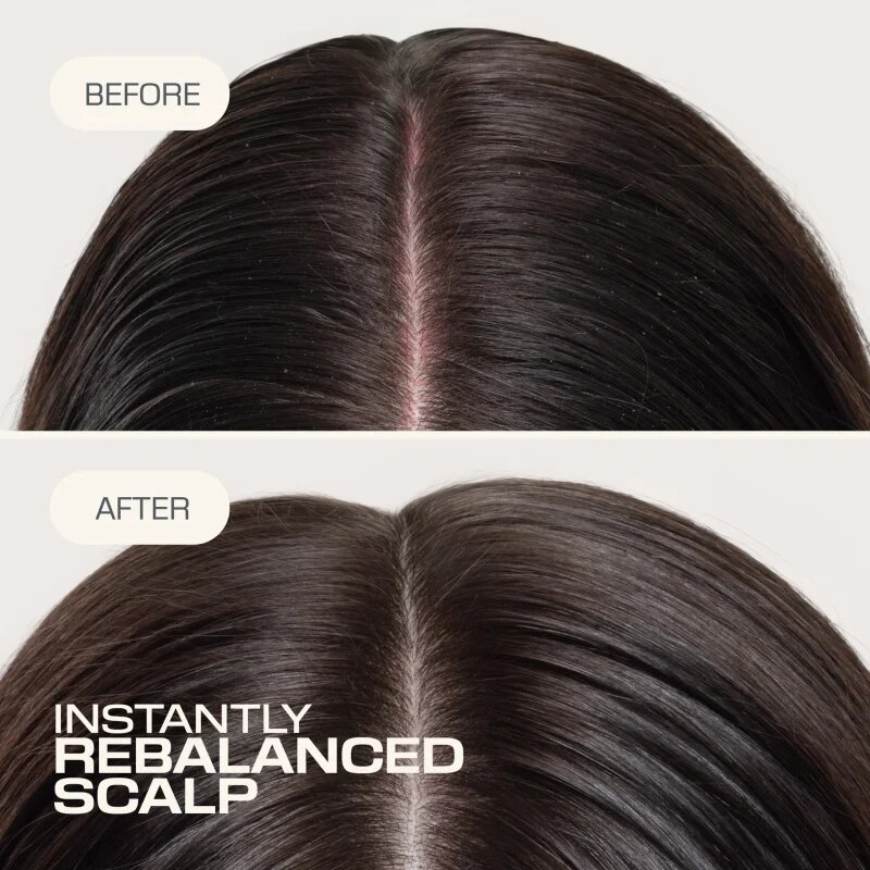 Goldwell Dualsenses Scalp Specialist Rebalance & Hydrate Fluid hydratační fluid pro obnovu pokožky hlavy 150 ml