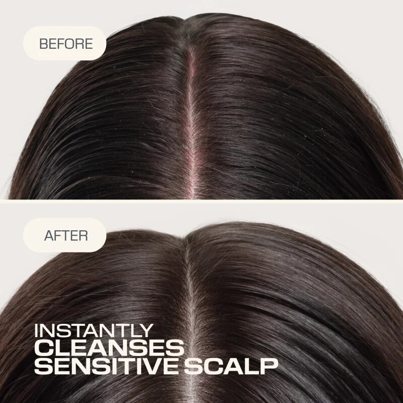 Goldwell Dualsenses Scalp Specialist Sensitive Foam Shampoo pěnový šampon pro citlivou pokožku hlavy 250 ml
