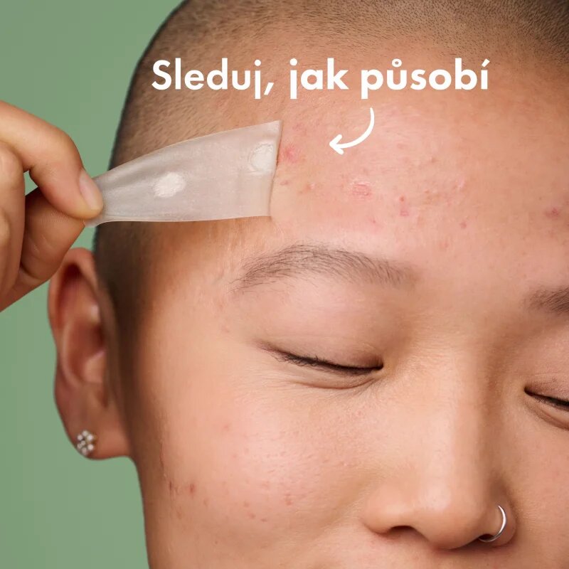 Hero Cosmetics Mighty Patch XL náplasti na problematickou pleť 10 ks
