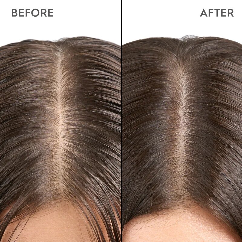 KERASILK Specialists Exfoliating Scalp & Hair Treatment předšamponová péče s exfoliačním účinkem 200 ml