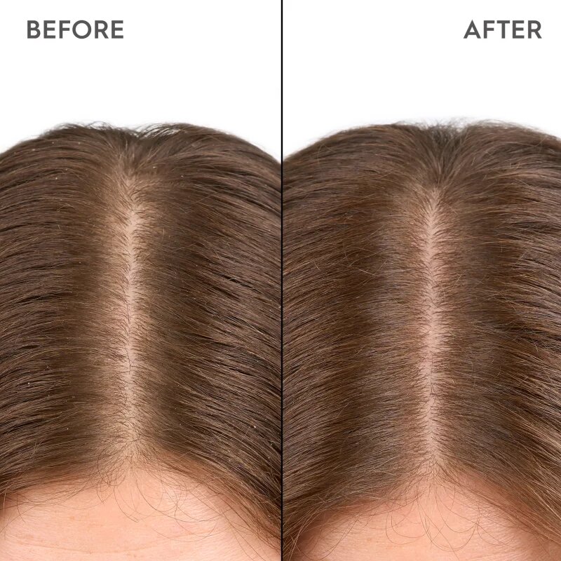 KERASILK Specialists Moisturizing Scalp Drops kapky pro suchou a citlivou pokožku hlavy 100 ml