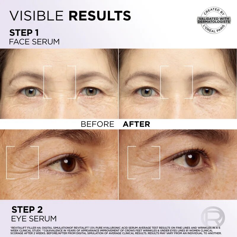L’Oréal Paris Revitalift Filler sada pro péči o pleť na obličej a oční okolí