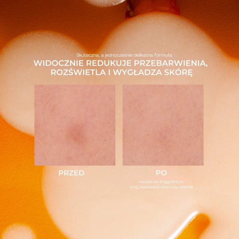 Lumene Nordic-C [VALO] Dark Spot Serum rozjasňující sérum s vitaminem C proti pigmentovým skvrnám 30 ml