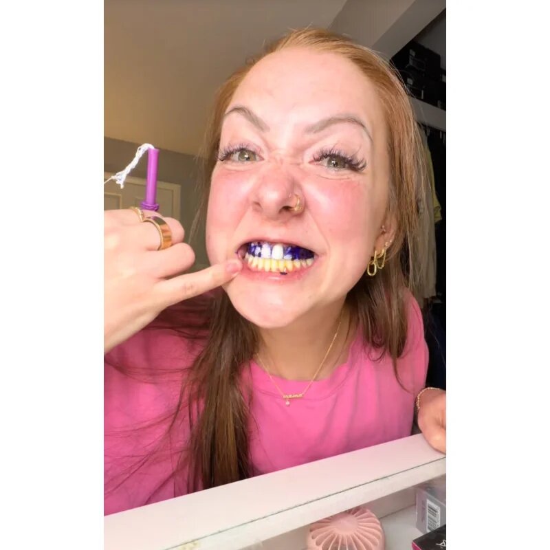 LYSS V34 bělicí pásky 1 ks